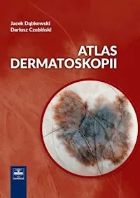 Atlas dermatoskopii Okazja