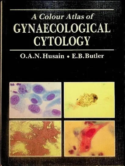 Ograniczona ilość A Colour Atlas of Gynaecological Cytology